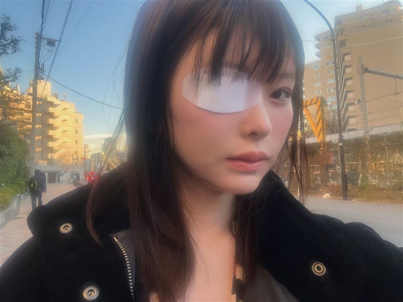 松本麗鈴的獨眼龍形象