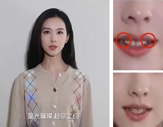 牙齒細節分析截圖