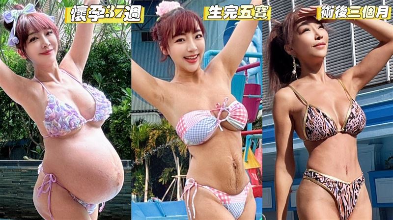 李宓手術過程