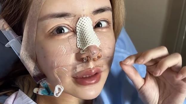 雪碧整形过程1