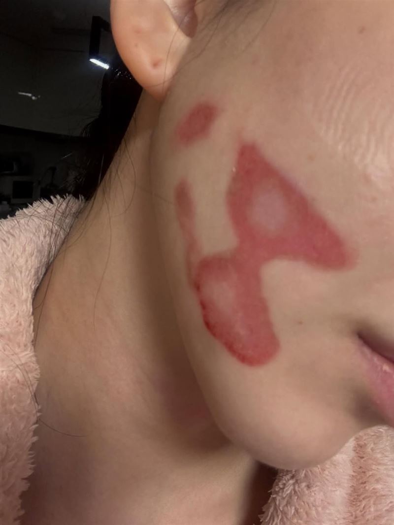 醫療事故照片