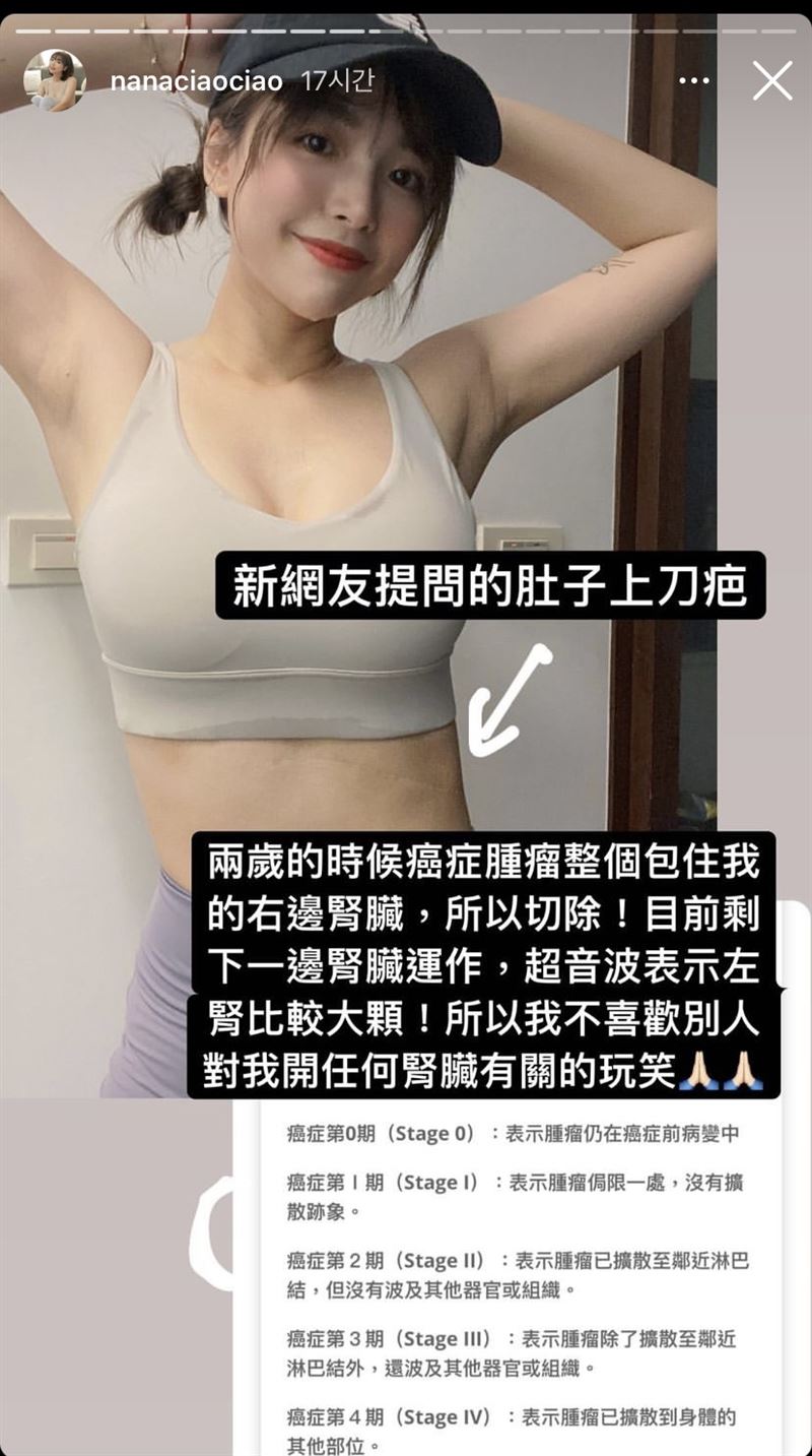 YouTuber一隻阿圓小時候就摘腎