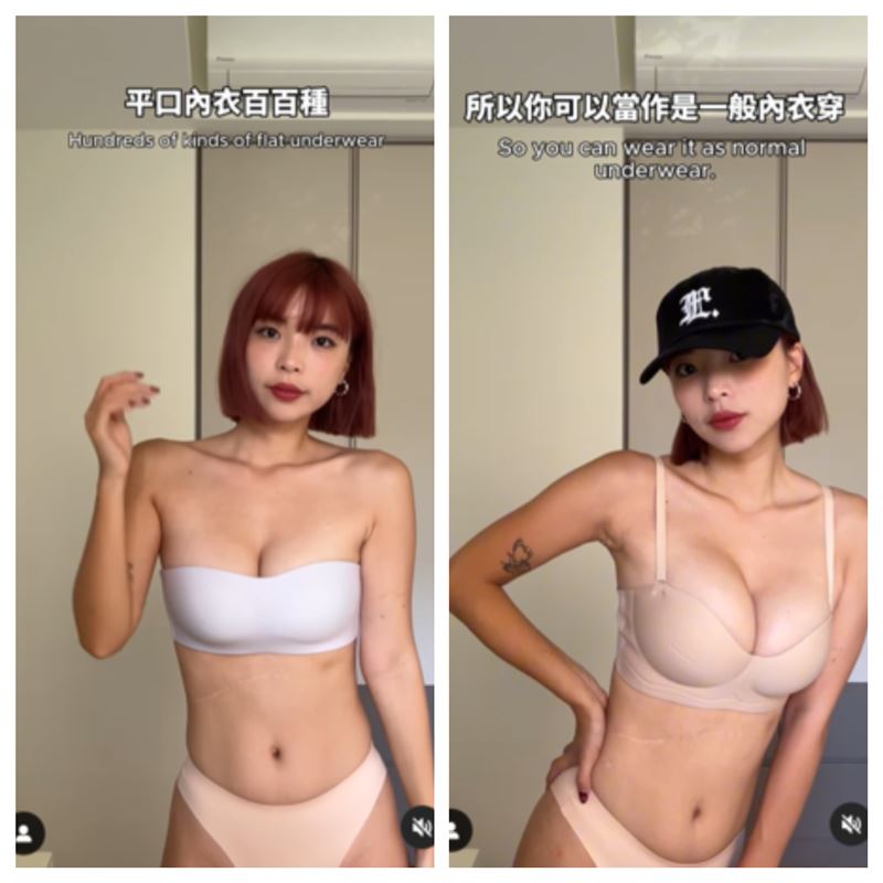 YouTuber「一隻阿圓」肚皮的疤痕