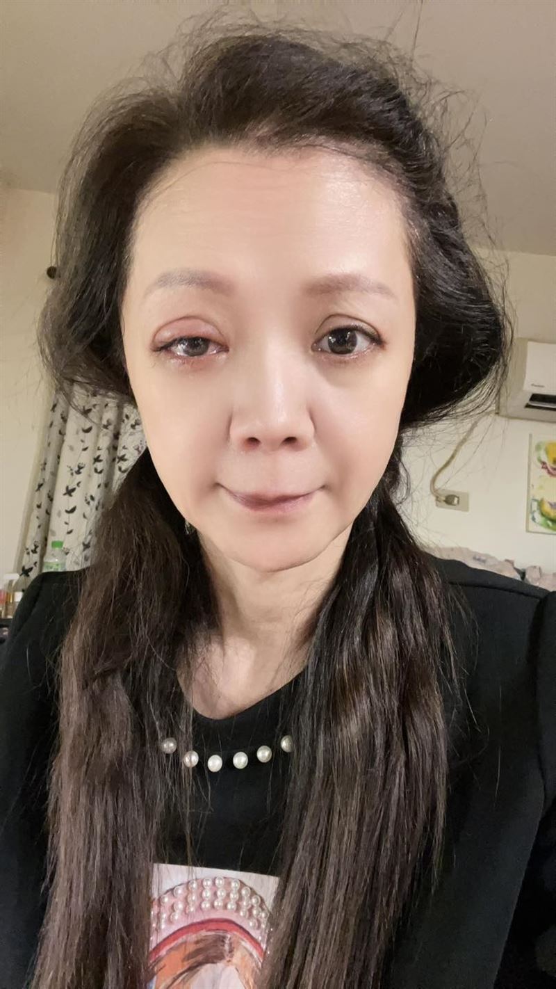 高欣欣点错眼药水示意图