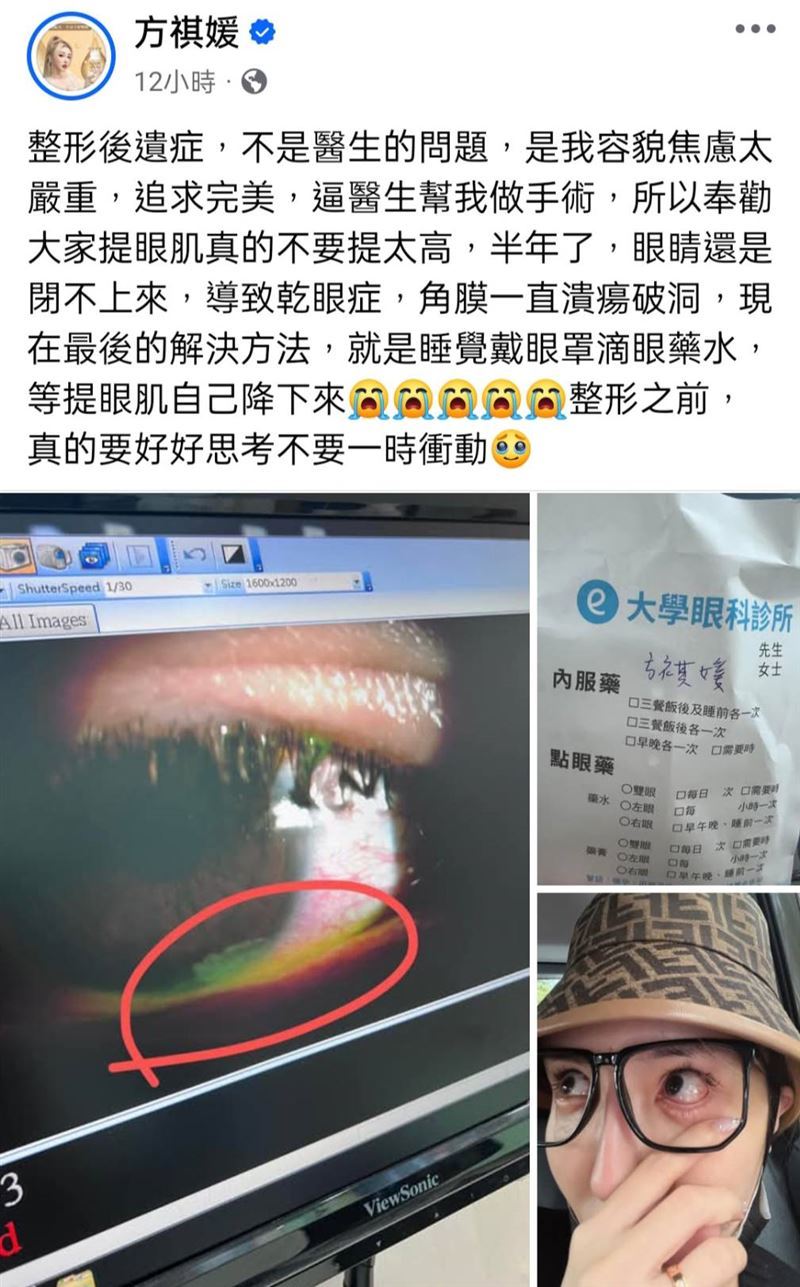 雪碧整形后遗症社媒截图