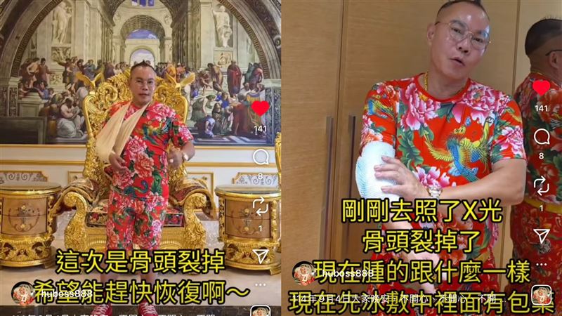 胡漢龑X光照影像