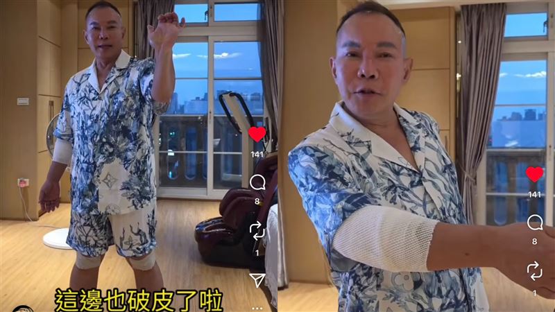 第三張傷勢照片