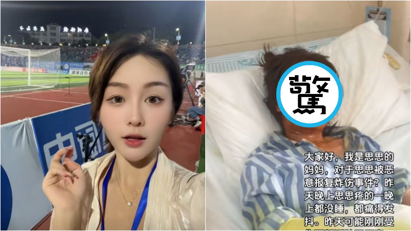 思思Alora遭包裹爆炸现场