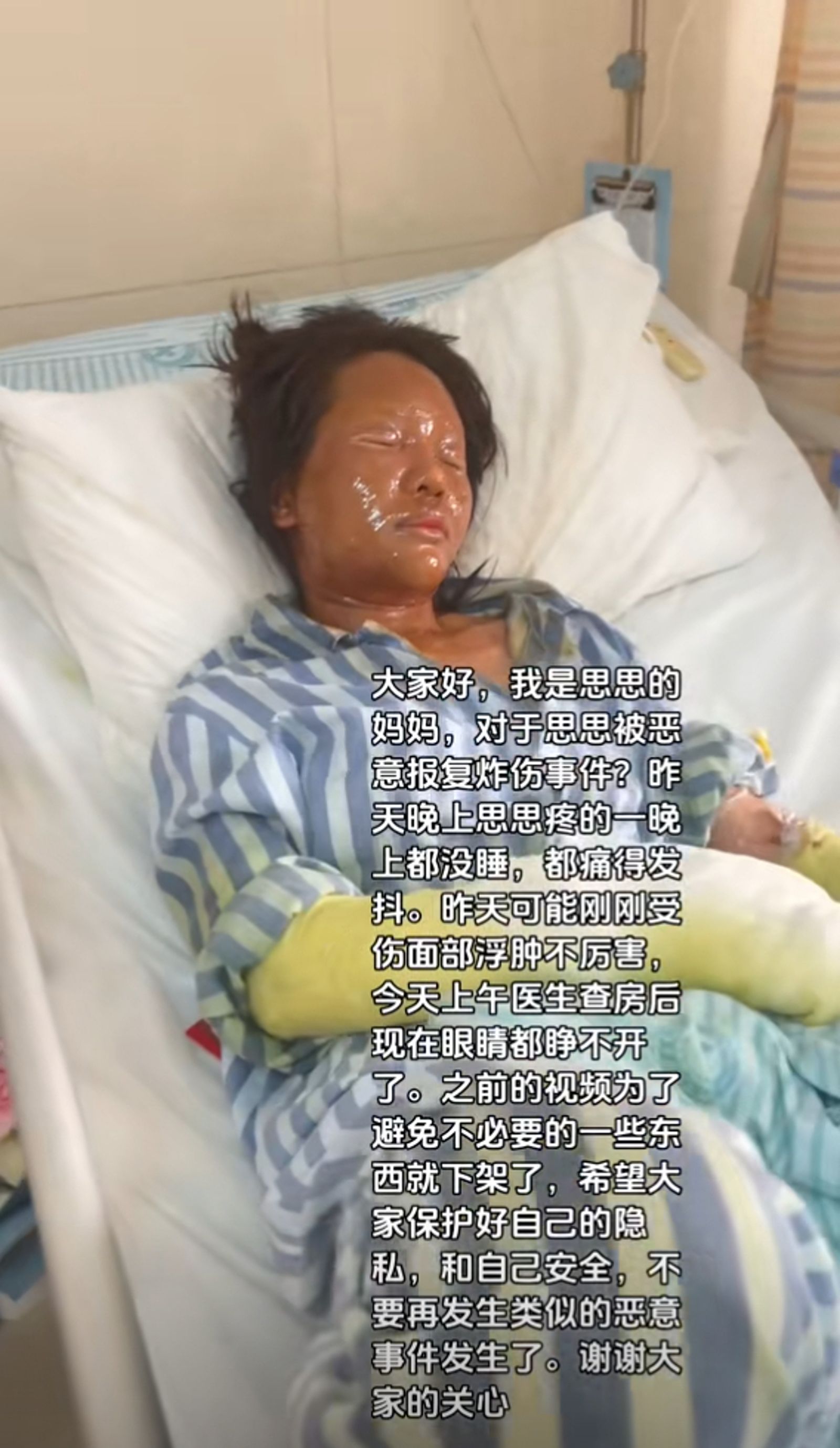 思思双手缠满绷带