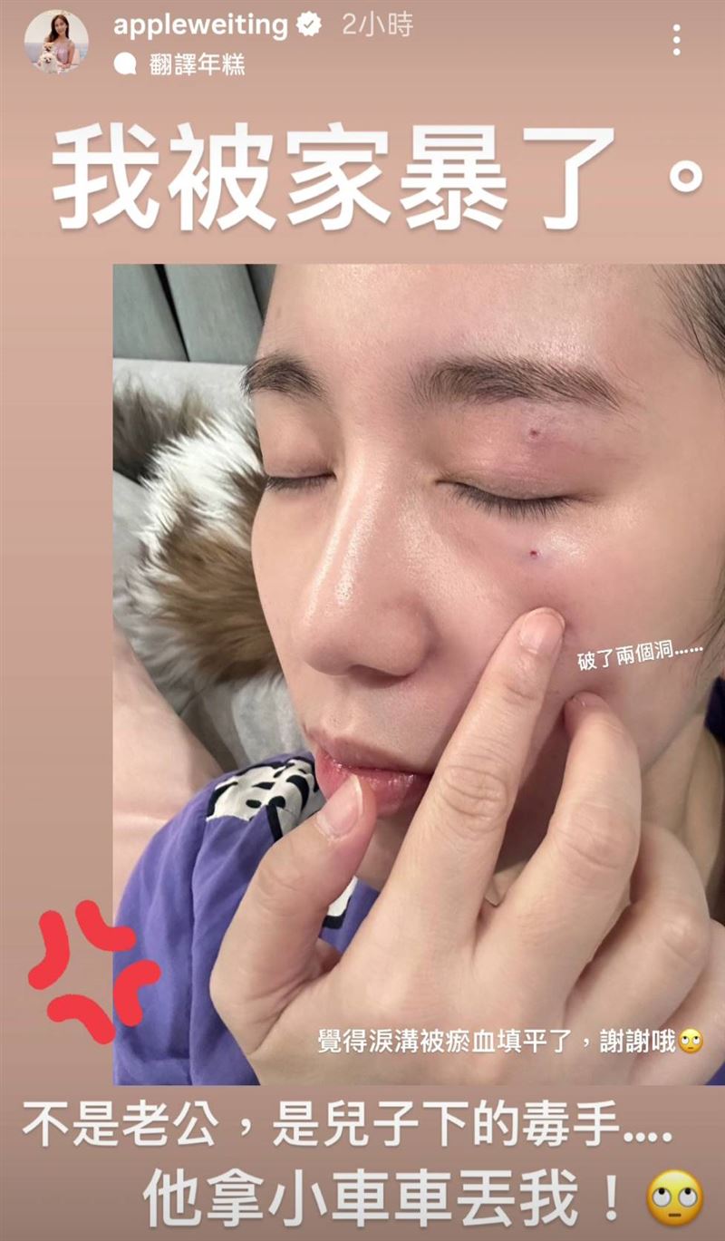 Apple 被家暴說被兒子玩具車砸的證據1