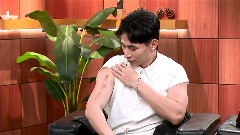 林家佑手臂留20公分疤痕