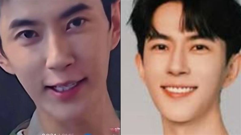 於朦朧去世前牙齒狀態對照