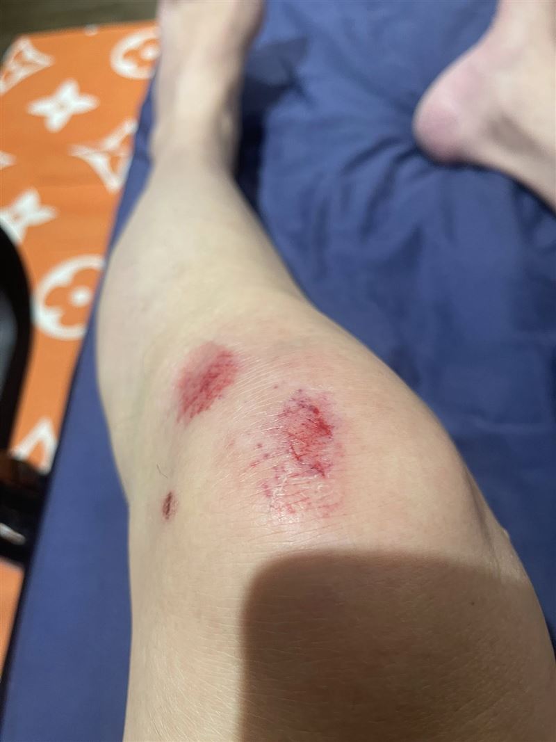 孫德榮4天摔跤3次