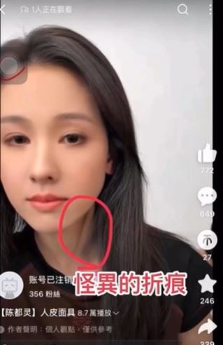 脖子有不自然摺痕