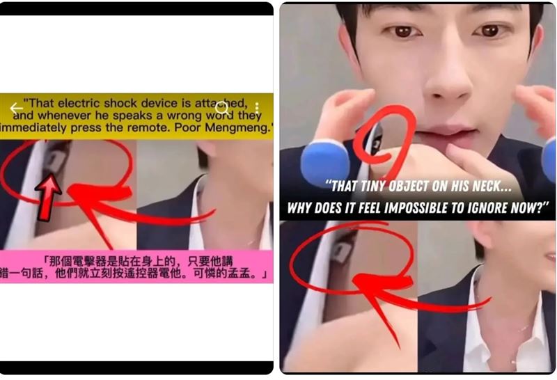 粉絲公布于朦朧生前直播戴電擊器的照片