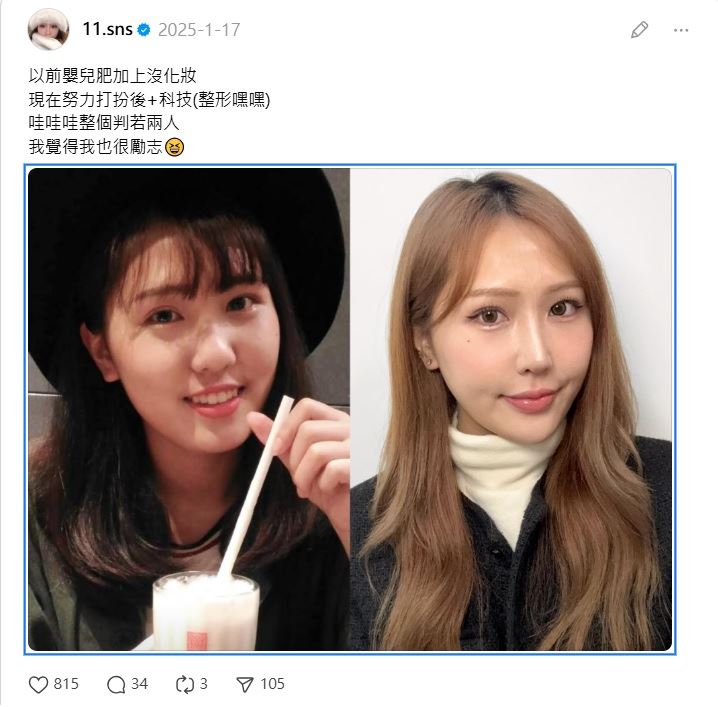 整形前後對比補充照片