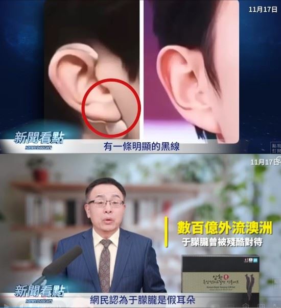 網友指稱耳朵連接與黑線